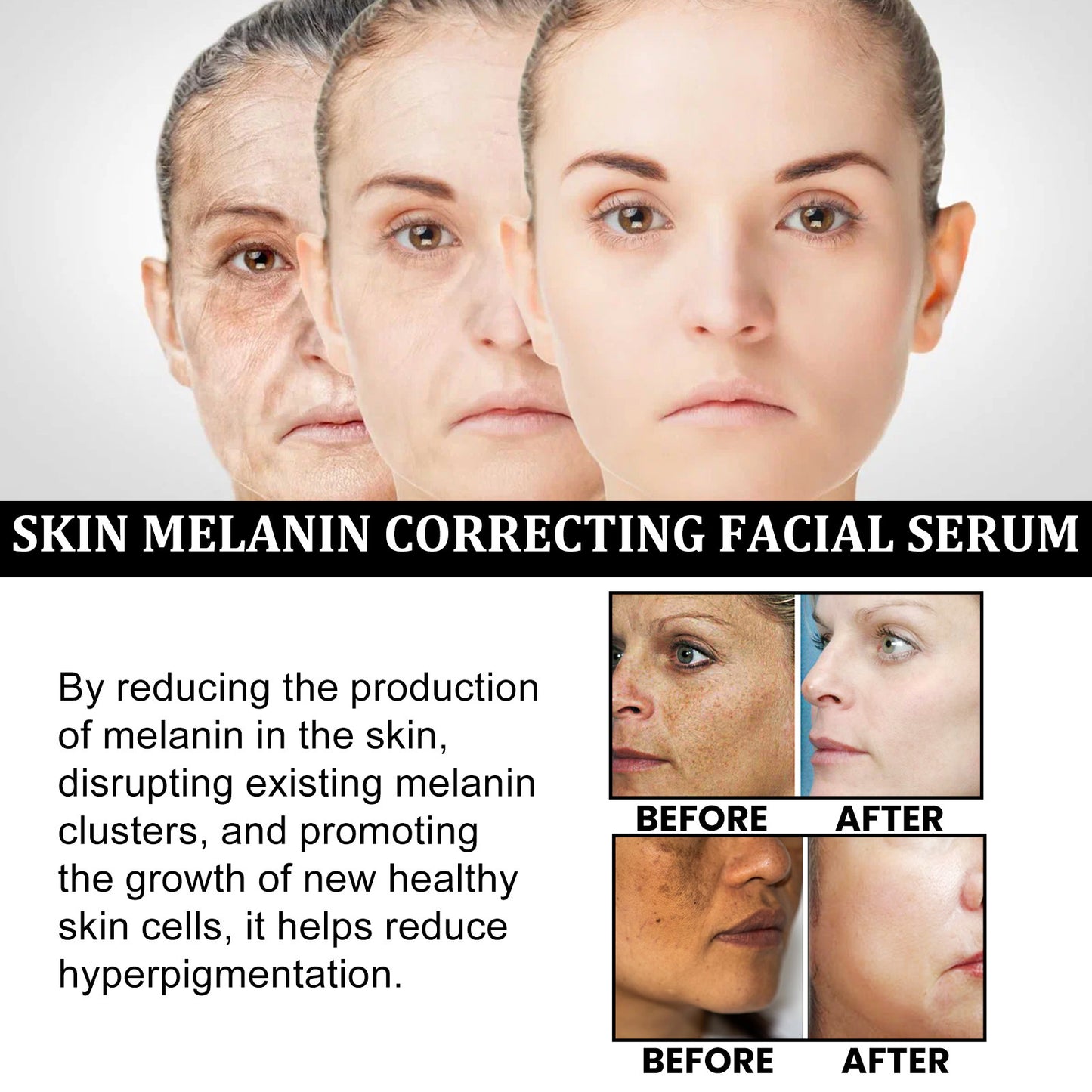 Facial Melanin Repair Hydrating Skincare Products